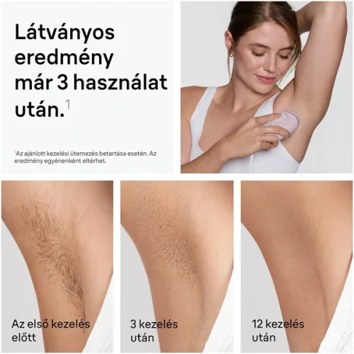 Braun Silk-Expert IPL PL1111 villanófényes szőrtelenítő